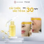 Palab B A17P5 Solution Ampouple